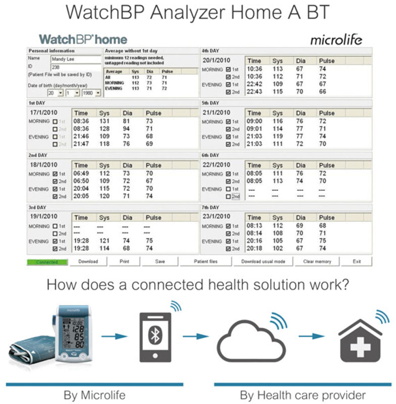 Home-A-BT-chart WatchBP Analyzer Home A BT
